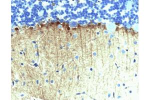 Immunohistochemical staining on rat cerebellum, formalin-fixed paraffin embedded tissue, with citrate pre-treatment (40X magnification). (ENAH Antikörper  (AA 415-541))