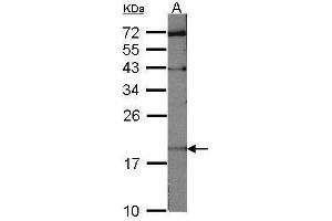 WB Image Sample (30 ug of whole cell lysate) A:NIH-3T3 12% SDS PAGE antibody diluted at 1:1000 (UBE2C Antikörper)