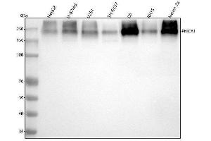 Western blot analysis of PMCA1 using anti-PMCA1 antibody (ABIN7605995).