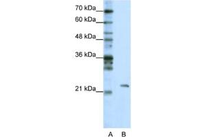 Western Blotting (WB) image for anti-Mitochondrial rRNA Methyltransferase 1 Homolog (MRM1) antibody (ABIN2462305) (MRM1 Antikörper)