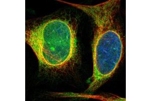 Immunofluorescent staining of human cell line U-2 OS shows localization to endoplasmic reticulum. (DERL1 Antikörper  (AA 186-251))