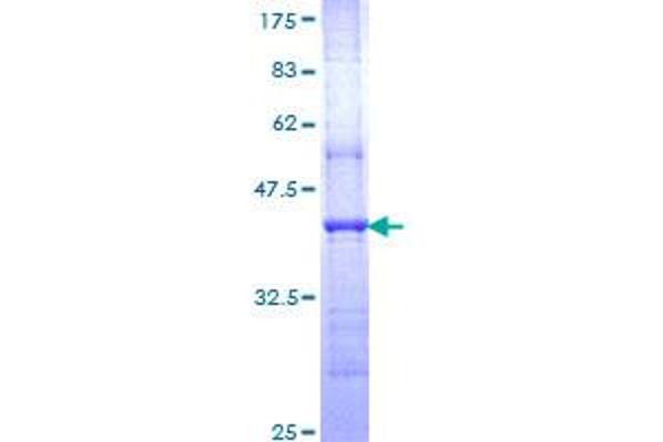 NR4A3 Protein (AA 414-521) (GST tag)