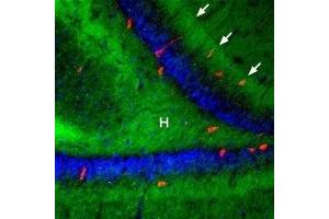 Expression of β3-Adrenoceptor in rat hippocampusImmunohistochemical staining of rat hippocampal dentate gyrus using Anti-β3-Adrenergic Receptor (extracellular) Antibody (ABIN7042907, ABIN7043912 and ABIN7043913), (1:100), (green). (Adrenergic, beta-3-, Receptor (ADRB3) Peptid)