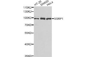 Western blot analysis of extracts of various cell lines, using SSRP1 antibody (ABIN2560151) at 1:1000 dilution. (SSRP1 Antikörper)