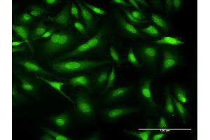 Immunofluorescence of monoclonal antibody to CALML3 on HeLa cell.