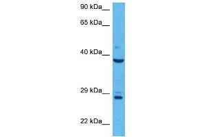 Host:  Rabbit  Target Name:  AGER  Sample Tissue:  Human MCF7 Whole Cell  Antibody Dilution:  1ug/ml (RAGE Antikörper  (N-Term))