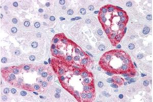 ABIN190762 (5µg/ml) staining of paraffin embedded Human Kidney. (APH1A Antikörper  (Internal Region))
