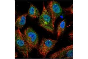 Image no. 3 for anti-Interleukin 6 (IL6) antibody (ABIN181728)