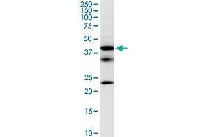 FCRLB monoclonal antibody (M01), clone 2F8.