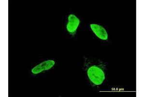 Immunofluorescence (IF) image for anti-Testis-Specific Kinase 2 (TESK2) (AA 405-542) antibody (ABIN564530)