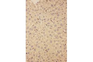 Anti-CD68 antibody,  IHC(P) IHC(P): Mouse Liver Tissue (CD68 Antikörper  (Middle Region))