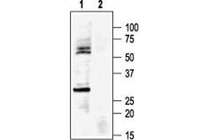 Western blot analysis of rat heart membranes: - 1.