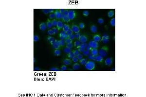 Sample Type :  Human Capan1 cells (Pancreatic cancer cell line)  Primary Antibody Dilution :  1:300  Secondary Antibody :   Anti-rabbit-AlexaFluor-488  Secondary Antibody Dilution :  1:200  Color/Signal Descriptions :  ZEB: Green DAPI: Blue  Gene Name :  ZEB1  Submitted by :  Dr. (ZEB1 Antikörper  (N-Term))
