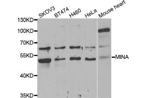 Western blot analysis of extracts of various cell lines, using MINA antibody (ABIN5974006) at 1/1000 dilution. (MINA Antikörper)