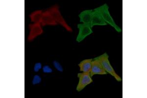 ABIN6259746 and ABIN6268898 staining Hela cells(30 min of UV treatment) by IF/ICC.
