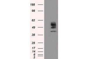 Image no. 3 for anti-Cytochrome P450, Family 1, Subfamily A, Polypeptide 2 (CYP1A2) antibody (ABIN1497712) (CYP1A2 Antikörper)