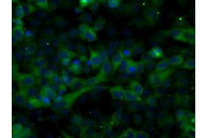 Image no. 9 for anti-Transforming, Acidic Coiled-Coil Containing Protein 3 (TACC3) antibody (ABIN1498097) (TACC3 Antikörper)