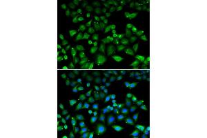 Immunofluorescence analysis of HeLa cell using NHLRC1 antibody. (NHLRC1 Antikörper)