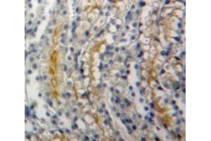 Used in DAB staining on fromalin fixed paraffin-embedded Kidney tissue (ADCY1 Antikörper  (AA 303-569))