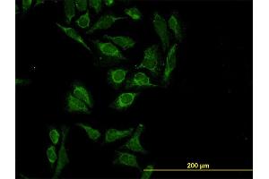 Immunofluorescence of monoclonal antibody to HTRA2 on HeLa cell. (HTRA2 Antikörper  (AA 359-458))