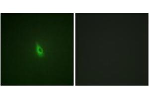 Immunofluorescence analysis of A549 cells, using Inositol 1, 4, 5-trisphosphate R1 (Phospho-Ser1598/1588) Antibody. (ITPR1 Antikörper  (pSer1598))