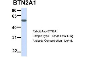 Host:  Rabbit  Target Name:  BTN2A1  Sample Type:  Human Fetal Lung  Antibody Dilution:  1.