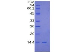 SDS-PAGE (SDS) image for S100 Calcium Binding Protein B (S100B) ELISA Kit (ABIN6730907)
