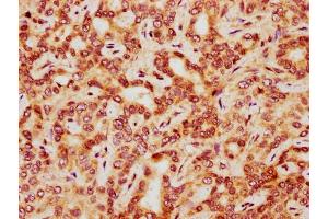 Immunohistochemistry (IHC) image for anti-Histone Cluster 1, H3a (HIST1H3A) (AA 37-48) antibody (ABIN7181545)