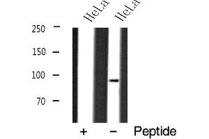 Western blot analysis of DNMT3B expression in HeLa cell lysate (DNMT3B Antikörper  (N-Term))