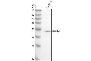Western blot analysis of HAND1 using anti-HAND1 antibody (ABIN7825442).