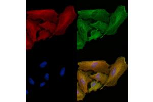 ABIN6262430 and ABIN6278873 staining  cells by IF/ICC. (IGFBP6 Antikörper  (Internal Region))
