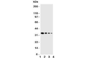 Western blot testing of GCN2 antbody;  Lane 1: Recombinant mouse protein 10ng;  2: 5ng;  3: 2.