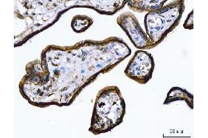 IHC analysis of Annexin A1/ANXA1 using anti-Annexin A1/ANXA1 antibody (ABIN7600491).