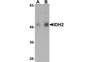 Western blot analysis of IDH2 in human heart tissue lysate with IDH2 antibody at (A) 1 and (B) 2 μg/ml. (IDH2 Antikörper  (N-Term))