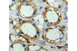 Used in DAB staining on fromalin fixed paraffin-embedded Kidney tissue (Neuregulin 2 Antikörper  (AA 101-211))