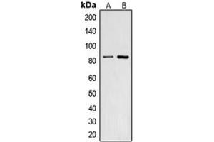 Western blot analysis of CNGA2 expression in HepG2 (A), A431 (B) whole cell lysates. (CNGA2 Antikörper  (Center))
