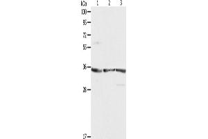 Western Blotting (WB) image for anti-Ribosomal Protein, Large, P0 (RPLP0) antibody (ABIN2422123) (RPLP0 Antikörper)