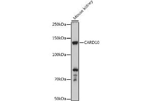 Western blot analysis of extracts of Mouse kidney, using C antibody (ABIN6127549, ABIN6137937, ABIN6137938 and ABIN6223226) at 1:500 dilution. (CARD10 Antikörper  (AA 863-1032))