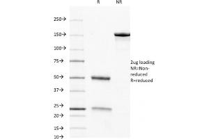 SDS-PAGE Analysis Purified CD8 Mouse Monoclonal Antibody (C8/468). (CD8 alpha Antikörper)