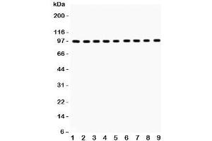 Western blot testing of GR antibody and Lane 1:  rat liver;  2: (r) brain;  3: (r) spleen;  4: human placenta;  5: (h) SMMC;  6: mouse HEPA;  7: (m) Neuro-2a;  8: (h) HeLa;  9: (r) PC12;  Predicted/Observed size: 91~94KD (GR (AA 20-199) Antikörper)