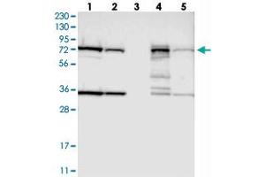 Western blot analysis of Lane 1: RT-4, Lane 2: U-251 MG, Lane 3: Human Plasma, Lane 4: Liver, Lane 5: Tonsil with HSD17B4 polyclonal antibody  at 1:250-1:500 dilution.