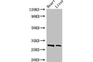 Western Blot Positive WB detected in: Mouse heart tissue, Mouse liver tissue All lanes: SPIC antibody at 3. (SPIC Antikörper  (AA 1-248))