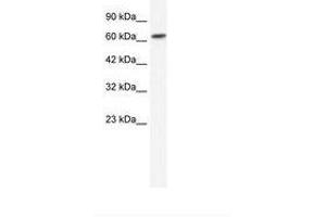 Image no. 1 for anti-gamma-aminobutyric Acid (GABA) A Receptor, beta 2 (GABRB2) (N-Term) antibody (ABIN202695) (GABRB2 Antikörper  (N-Term))