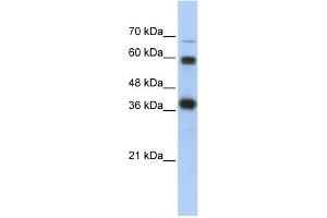 WB Suggested Anti-NRF1 Antibody Titration:  0. (NRF1 Antikörper  (N-Term))
