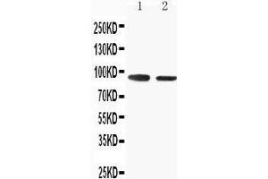 Anti-SLC9A2 antibody, Western blotting Lane 1: Rat Skeletal Musle Tissue Lysate Lane 2: Rat Kidney Tissue Lysate (SLC9A2 Antikörper  (C-Term))