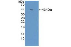 Detection of Recombinant ACTg1, Human using Polyclonal Antibody to Gamma Actin (ACTG) (Actin, gamma 1 Antikörper  (AA 1-375))
