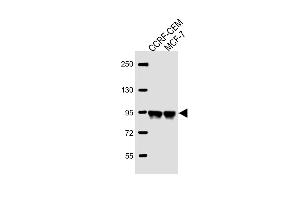 All lanes : Anti-AFTPH Antibody (C-term) at 1:2000 dilution Lane 1: CCRF-CEM whole cell lysate Lane 2: MCF-7 whole cell lysate Lysates/proteins at 20 μg per lane. (Aftiphilin Antikörper  (C-Term))
