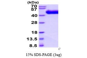 SDS-PAGE (SDS) image for Interleukin 1 Receptor-Like 1 (IL1RL1) (AA 19-328) protein (His tag) (ABIN5854643) (IL1RL1 Protein (AA 19-328) (His tag))