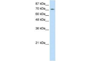 Western Blot showing ZNF527 antibody used at a concentration of 1-2 ug/ml to detect its target protein. (ZNF527 Antikörper  (C-Term))