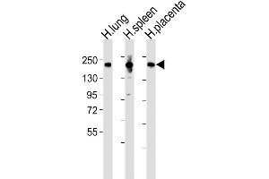 Western Blot at 1:2000 dilution Lane 1: human lung lysates Lane 2: human spleen lysates Lane 3: human placenta lysates Lysates/proteins at 20 ug per lane. (Macrophage Mannose Receptor 1 Antikörper  (N-Term))